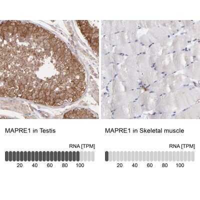 Immunohistochemistry-Paraffin: MAPRE1 Antibody [NBP1-84928] - Staining in human testis and skeletal muscle tissues using anti-MAPRE1 antibody. Corresponding MAPRE1 RNA-seq data are presented for the same tissues.