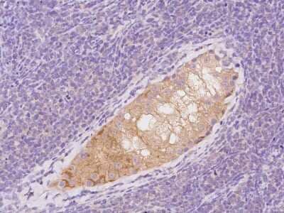 Immunohistochemistry-Paraffin: MAPRE1 Antibody [NBP2-97333] - Immunochemical staining of human MAPRE1 in human testis with rabbit polyclonal antibody at 1:100 dilution, formalin-fixed paraffin embedded sections.