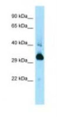 Western Blot: MAPRE1 Antibody [NBP1-98366] - Mouse Spleen Lysate 1.0ug/ml, Gel Concentration: 12%