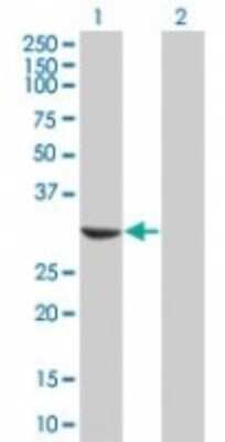Western Blot: MAPRE1 Antibody [NBP2-24946] - Analysis using the Azide Free version of NBP2-24946. Detection of MAPRE1 in 1) transfected 293T cells and 2) untransfected 293T cells using NBP2-24947 at 1:500.