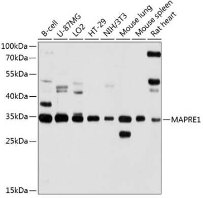 Western Blot: MAPRE1 Antibody [NBP3-04693] - Analysis of extracts of various cell lines, using MAPRE1 antibody at 1:1000 dilution. Secondary antibody: HRP Goat Anti-Rabbit IgG (H+L) at 1:10000 dilution. Lysates/proteins: 25ug per lane. Blocking buffer: 3% nonfat dry milk in TBST. Detection: ECL Basic Kit