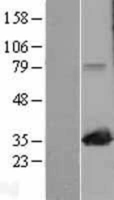 Western Blot MAPRE1 Overexpression Lysate