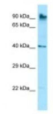 Western Blot: MARCH10 Antibody [NBP1-98327] - Rat Stomach Lysate. Antibody at 1.0 ug/mL.