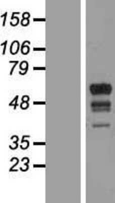 Western Blot: MARCH10 Overexpression Lysate (Adult Normal) [NBP2-10938] Left-Empty vector transfected control cell lysate (HEK293 cell lysate); Right -Over-expression Lysate for MARCH10.