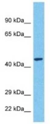 Western Blot: MARCH11 Antibody [NBP3-10571] - Western blot analysis of MARCH11 in Fetal Kidney lysates. Antibody dilution at 1ug/ml