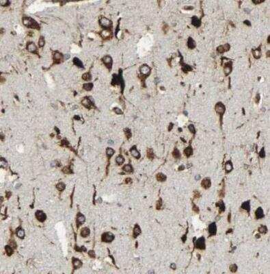 Immunohistochemistry-Paraffin: MARCH2 Antibody [NBP1-91638] - Staining of human cerebral cortex shows strong cytoplasmic and granular cytoplasmic positivity in neurons.