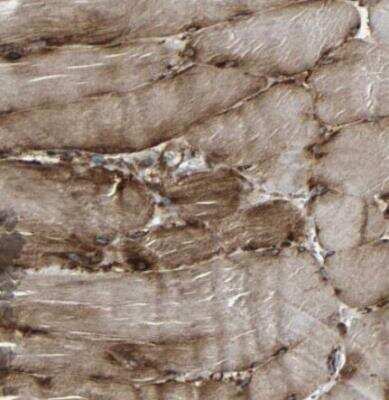 Immunohistochemistry-Paraffin: MARCH2 Antibody [NBP1-91638] - Staining of human skeletal muscle shows strong cytoplasmic and granular cytoplasmic positivity in myocytes.
