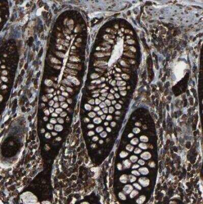 Immunohistochemistry-Paraffin: MARCH2 Antibody [NBP1-91638] - Staining of human colon shows strong cytoplasmic and granular cytoplasmic positivity in glandular cells.