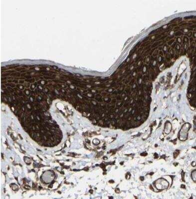 Immunohistochemistry-Paraffin: MARCH2 Antibody [NBP1-91638] - Staining of human skin shows strong cytoplasmic and granular cytoplasmic positivity in squamous epithelial cells.