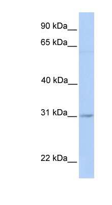 Western Blot: MARCH2 Antibody [NBP1-60051] - Jurkat cell lysate, concentration 0.2-1 ug/ml.