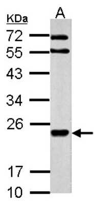 Western Blot MARCH2 Antibody