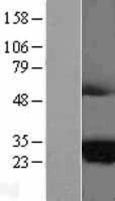 Western Blot MARCH2 Overexpression Lysate