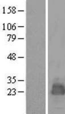 Western Blot MARCH2 Overexpression Lysate