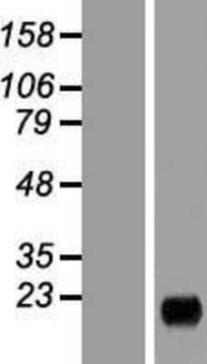 Western Blot:MARCH2过表达裂解液（成人正常）[NBP2-10746]Left-Empty载体转染对照细胞裂解液（HEK293细胞裂解液）；右-MARCH2过度表达裂解液。