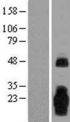 Western Blot: MARCH3 Overexpression Lysate (Adult Normal) [NBL1-06999] Left-Empty vector transfected control cell lysate (HEK293 cell lysate); Right -Over-expression Lysate for MARCH3.