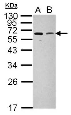 Western Blot: MARCH5 Antibody [NBP2-21583] - Sample (20 ug of whole cell lysate) A: HeLa B: HeLa membrane, 12% SDS PAGE gel, diluted at 1:1000.