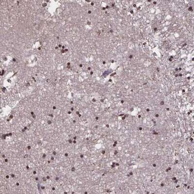 Immunohistochemistry: MARCH6 Antibody [NBP2-38987] - Staining of human hippocampus shows strong nuclear positivity in glial cells.