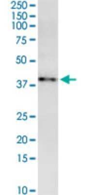 Western Blot: MARCH9 Antibody (2B5) [H00092979-M01] - MARCH9 monoclonal antibody (M01), clone 2B5. Analysis of MARCH9 expression in Hela S3 NE.