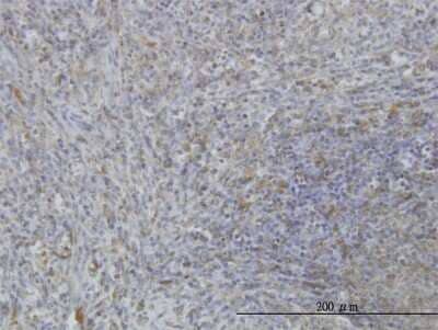 Immunohistochemistry-Paraffin: MARCKS Antibody (2C2) [H00004082-M06] - Analysis of monoclonal antibody to MARCKS on formalin-fixed paraffin-embedded human spleen. Antibody concentration 3 ug/ml