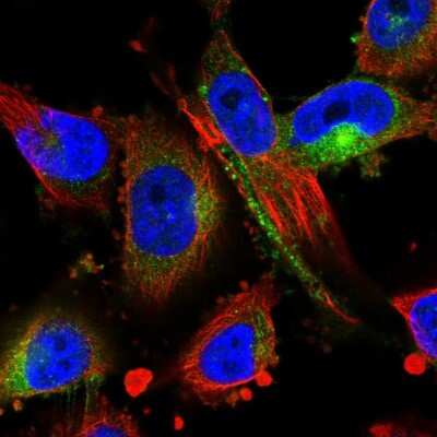 Immunocytochemistry/Immunofluorescence: MARCKS Antibody [NBP2-58267] - Staining of human cell line U-251 MG shows localization to cytosol.