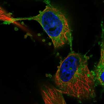 Immunocytochemistry/Immunofluorescence: MARCKS Antibody [NBP2-68861] - Staining of human cell line U-251 MG shows localization to plasma membrane & endoplasmic reticulum.