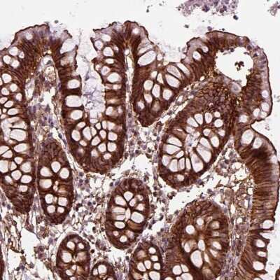 Immunocytochemistry/Immunofluorescence: MARCKS Antibody [NBP2-68861] - Immunohistochemical staining of human colon shows strong cytoplasmic and membranous positivity in glandular cells.