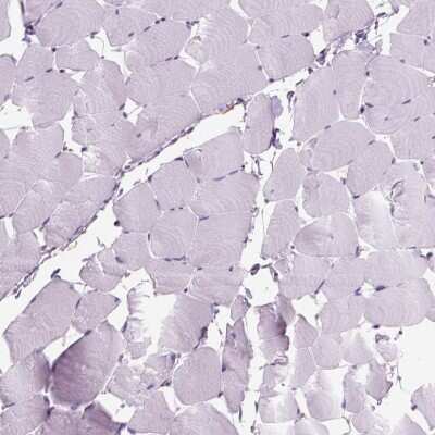 <b>Orthogonal Strategies Validation. </b>Immunohistochemistry-Paraffin: MARCKS Antibody [NBP2-62663] - Staining of human skeletal muscle shows low expression as expected.