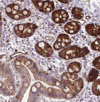 Immunohistochemistry-Paraffin: MARCKS like protein Antibody [NBP2-38160] - Staining of human duodenum shows strong cytoplasmic and membranous positivity in glandular cells.