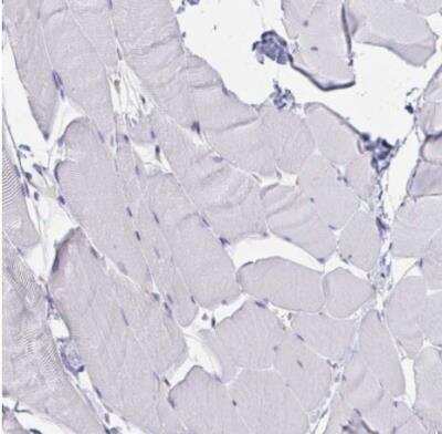 Immunohistochemistry-Paraffin: MARCKS like protein Antibody [NBP2-38160] - Staining of human skeletal muscle shows no cytoplasmic positivity in myocytes as expected.