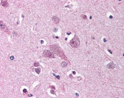 Immunohistochemistry-Paraffin: MARK1 Antibody [NBP1-02666] - Staining of human brain, cortex. Immunohistochemistry of formalin-fixed, paraffin-embedded tissue after heat-induced antigen retrieval. Antibody concentration 5 ug/ml.
