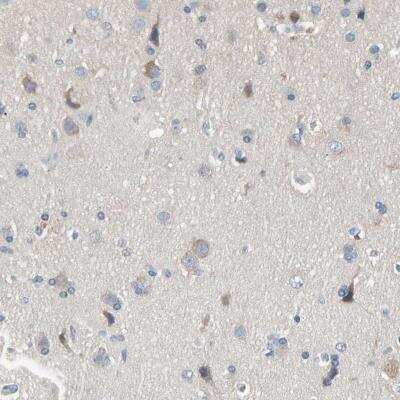 Immunohistochemistry-Paraffin: MARK1 Antibody [NBP1-82799] - Staining of human cerebral cortex shows cytoplasmic positivity in neuronal cells.