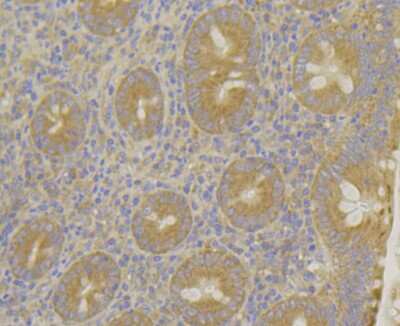 Immunohistochemistry-Paraffin: MARK2 Antibody (JE40-97) [NBP2-75566] - Analysis of paraffin-embedded human appendix tissue using anti-MARK2 antibody. Counter stained with hematoxylin.