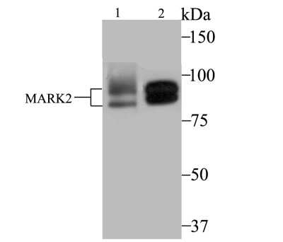 Western Blot: MARK2 Antibody (JE40-97) [NBP2-75566] - Analysis of MARK2 on MCF-7 (1) and SK-Br-3 (2) cell lysate using anti-MARK2 antibody at 1/2,000 dilution.