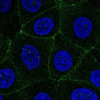 Immunocytochemistry/Immunofluorescence: MARVELD2 Antibody [NBP2-57449] - Staining of human cell line MCF7 shows localization to cell junctions.