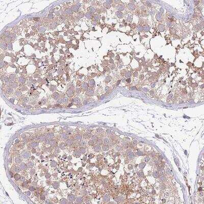 Immunohistochemistry: MARVELD2 Antibody [NBP2-14222] - Staining of human testis shows moderate cytoplasmic positivity in cells in seminiferus ducts.