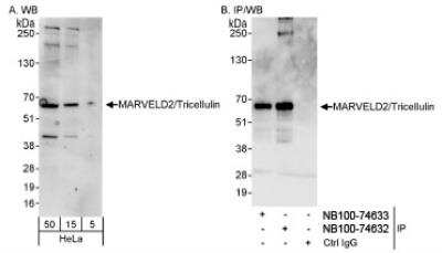 Western Blot: MARVELD2 Antibody [NB100-74632] - WB and IP:  NB100-74632-Detection of Human MARVELD2/Tricellulin on HeLa whole cell lysate using NB100-74632. MARVELD2/Tricellulin was also immunoprecipitated by rabbit anti-MARVELD2/Tricellulin antibody NB100-74633.
