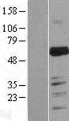 Western Blot: MARVELD2 Overexpression Lysate (Adult Normal) [NBL1-12902] Left-Empty vector transfected control cell lysate (HEK293 cell lysate); Right -Over-expression Lysate for MARVELD2.