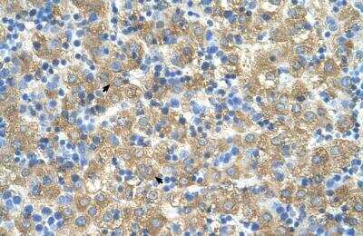 Immunohistochemistry-Paraffin MARVELD3 Antibody