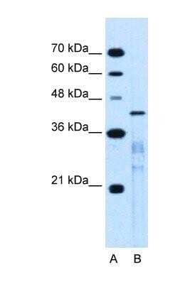 Western Blot MARVELD3 Antibody