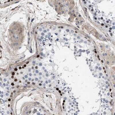 Immunohistochemistry-Paraffin: MAS1L Antibody [NBP1-85157] - Staining of human testis shows strong positivity in basal cells of ductus seminiferus.