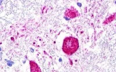 Immunohistochemistry-Paraffin: MAS1L Antibody [NLS187] - Anti-MAS1L / MRG antibody IHC of human brain, medulla, neurons. Immunohistochemistry of formalin-fixed, paraffin-embedded tissue after heat-induced antigen retrieval. Antibody dilution 2-3 ug/ml.