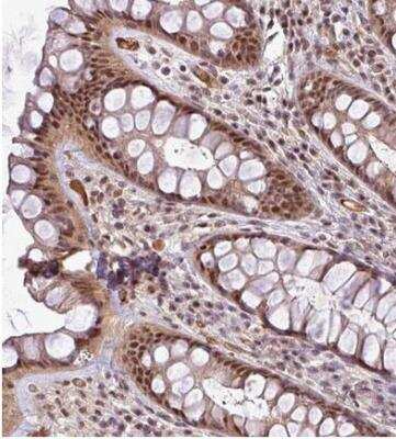 Immunohistochemistry-Paraffin MASL1 Antibody