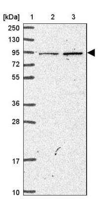 Western Blot MASL1 Antibody