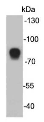 Western Blot: MASP2 Antibody (F3-4) [NBP2-66941] - Analysis on human serum lysate using anti-MASP2 mouse mAb.