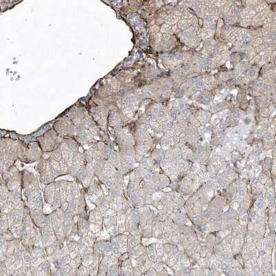 Immunohistochemistry-Paraffin: MASP2 Antibody [NBP1-81258] - Staining of human liver shows moderate membranous positivity.