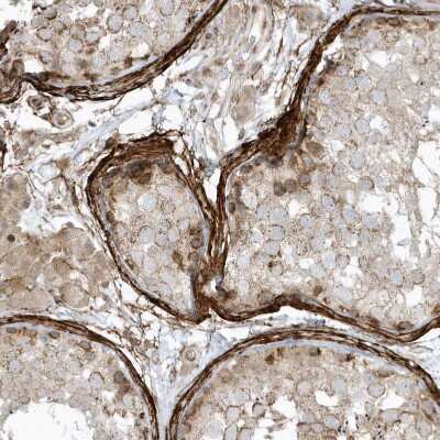Immunohistochemistry-Paraffin: MASP2 Antibody [NBP1-81258] - Staining of human testis shows strong membranous positivity in peritubular myoid cells.