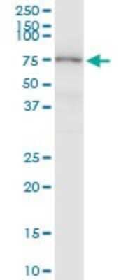 Western Blot: MASP2 Antibody [H00010747-D01P] - Analysis of MASP2 expression in human spleen.