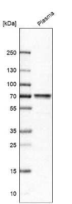 Western Blot MASP2 Antibody