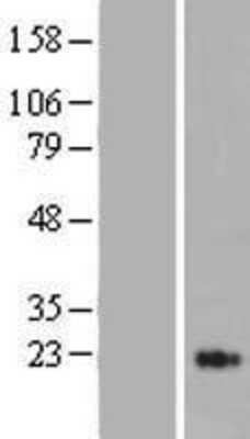 Western Blot MASP2 Overexpression Lysate