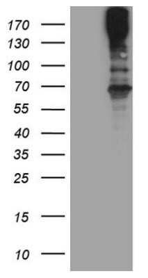 Western Blot: MAST205 Antibody (OTI3A5) - Azide and BSA Free [NBP2-72592] - HEK293T cells were transfected with the pCMV6-ENTRY control (Left lane) or pCMV6-ENTRY MAST2 (Right lane) cDNA for 48 hrs and lysed. Equivalent amounts of cell lysates (5 ug per lane) were separated by SDS-PAGE and immunoblotted with anti-MAST2.